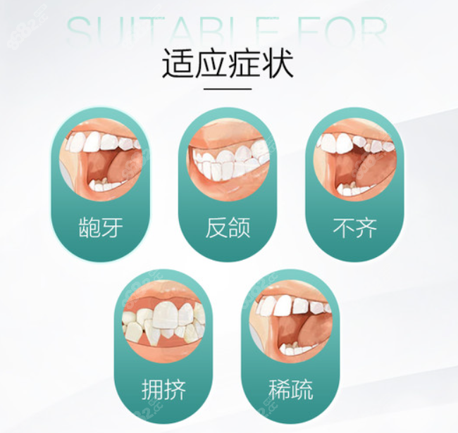 牙齿矫正适应症状表现