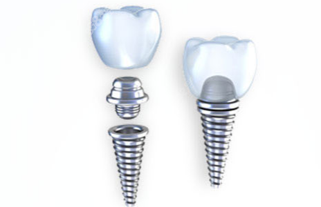 <!--<i data=20240705-sp></i>-->口腔和維樂口腔種牙技術(shù)對比看哪個好