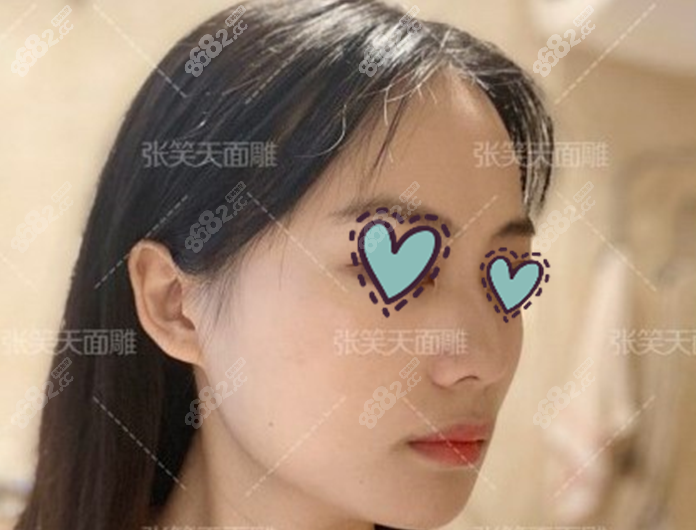 温柔的猫术后7个月