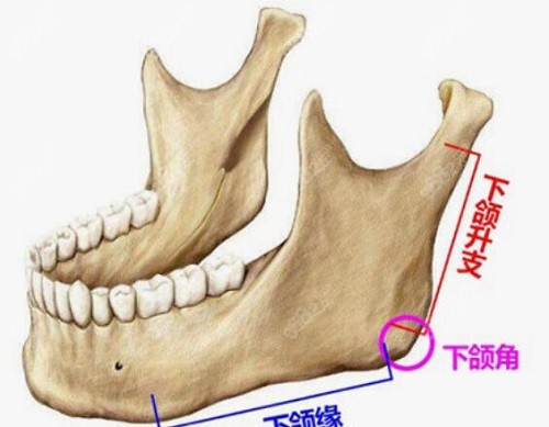 下颌角方面张笑天医生重新塑造一个角,包含了对角度大小和位置的处理