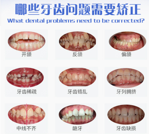 牙齿问题