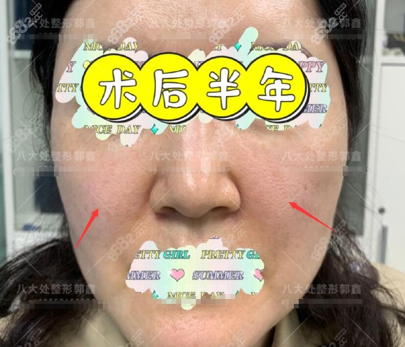 看完北京八大处郭鑫最擅长做什么在问他取生长因子靠谱吗