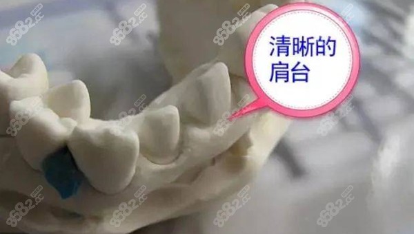 美奥姑苏口腔当天到场好礼，牙齿矫正所需的牙齿取模才99元起