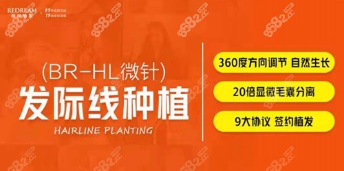 杭州薇琳发际线种植