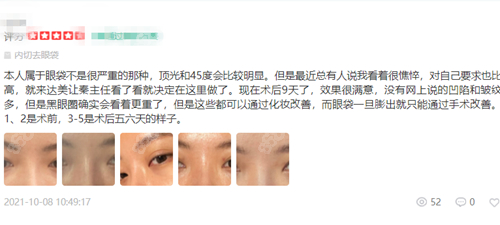 北京达美如意医疗美容去眼袋术后反馈