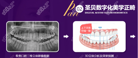  上海圣贝的数字化正畸