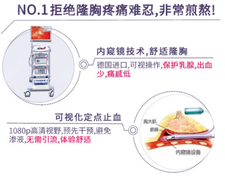 内窥镜隆胸术的优势