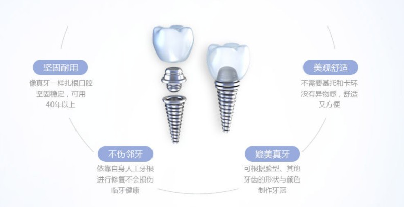 来了解一下什么是种植牙以及种植牙的优点吧