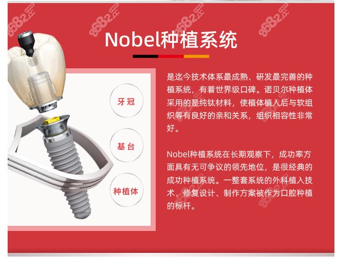 瑞典诺贝种植系统的具体介绍