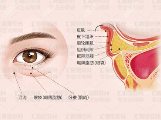 眼袋的結(jié)合