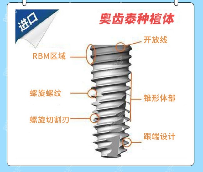 韩国奥齿泰植体介绍