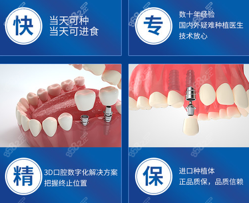 美奥口腔的种植牙技术好不好