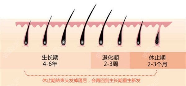 植发术后恢复期间