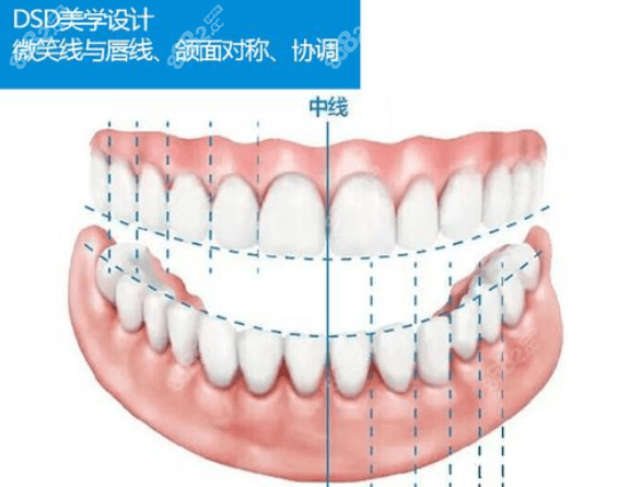 深圳世纪河山口腔做牙齿矫正技术进行美学设计