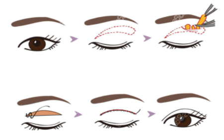 20211102471574.png 4.png