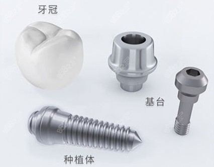 北京瑞泰口腔美国隐适美隐形矫正直降1万+的价格了解下