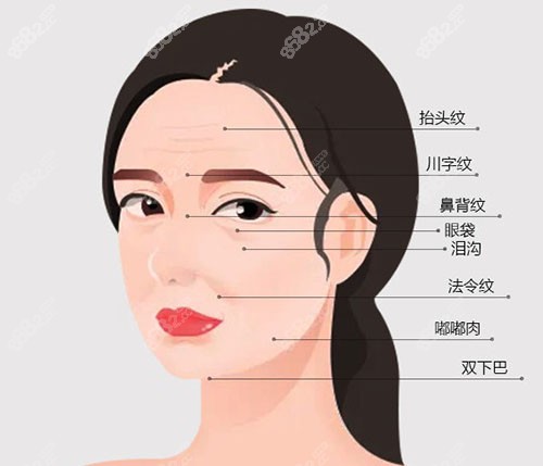 医生非常擅长电磁波面部提升除皱手术