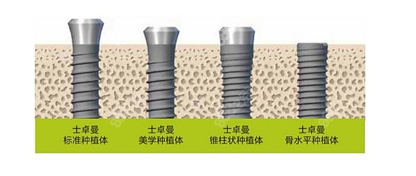 瑞士士卓曼种植体的各型号