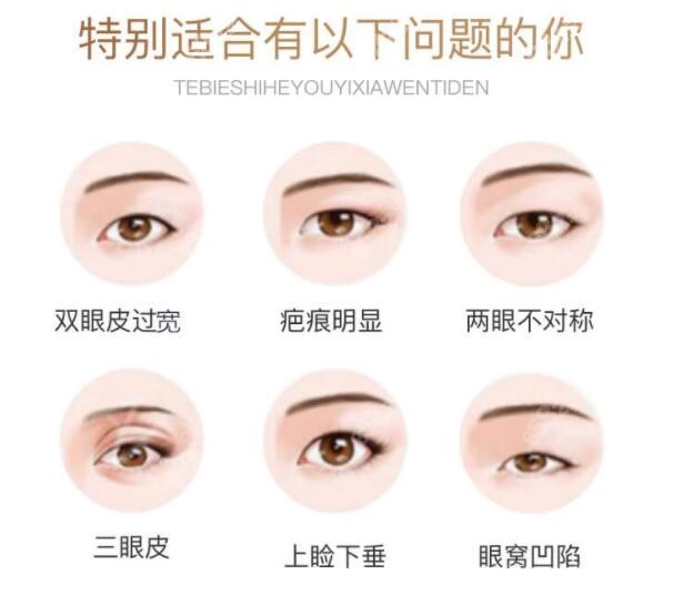 不好看眼睛症状