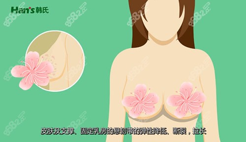 韩啸整形医院人工韧带乳房提升术