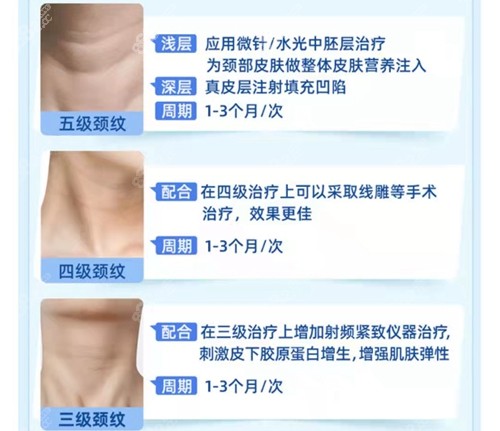 广美美莱祛颈纹方案 广美美莱祛颈纹方案