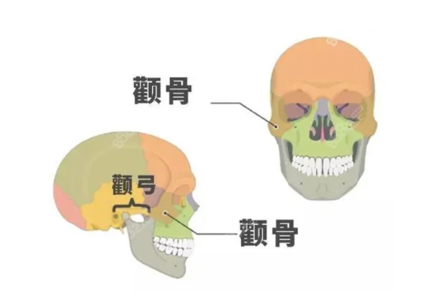 颧骨颧弓示意图