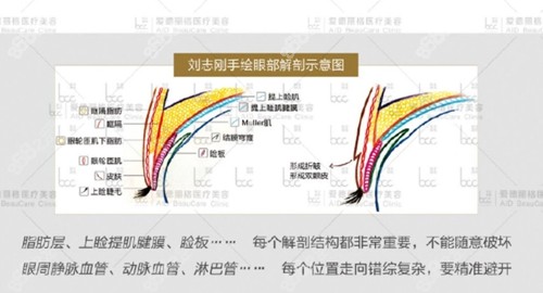 大连刘志刚割双眼皮靠谱吗