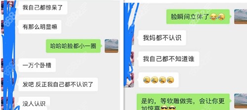 隆鼻术后反馈