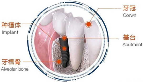 各種種植技術(shù)成熟嗎