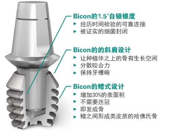 百康种植牙具备的特色优势