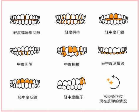 需要做牙齿矫正展示图