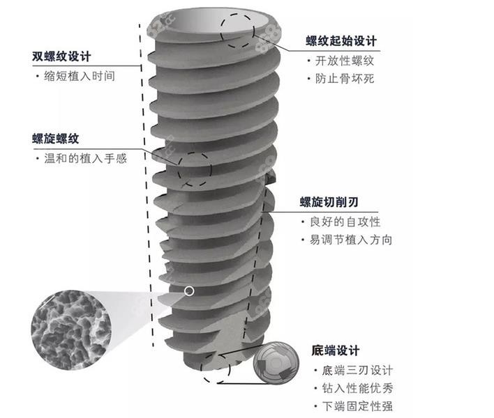 美国皓圣hiossen种植体的收费标准