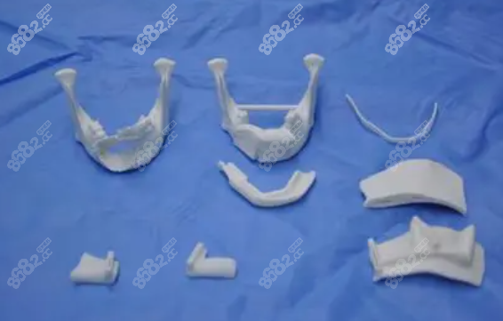 正颌3d数字化技术