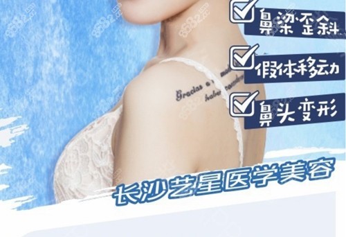 长沙艺星隆鼻优势介绍