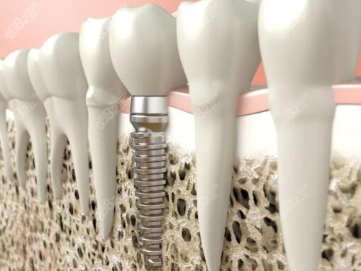 岳陽哪個口腔醫(yī)院好