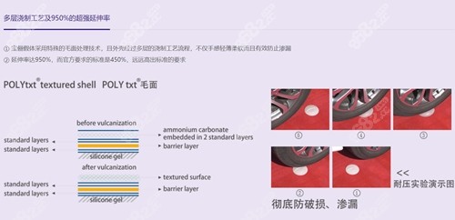 德国宝俪假体优势介绍