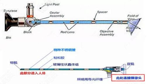 内窥镜窥管示意图