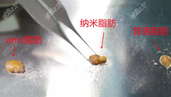 amc脂肪和纳米脂肪及普通脂肪的区别