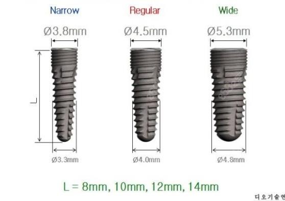 韩国迪奥dio种植体怎么样，型号有哪些？