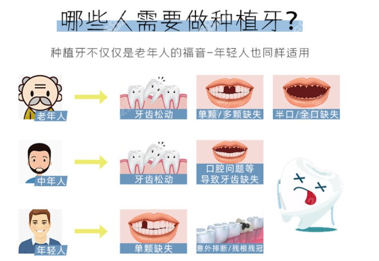看看种植牙适应症有哪些