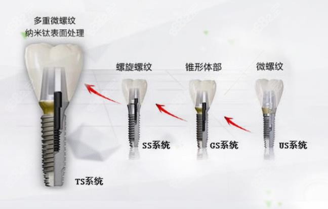 韩国奥齿泰osstem种植体怎么样呢？