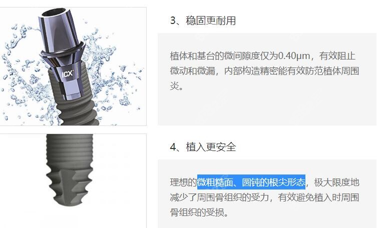 德国icx种植体的优势