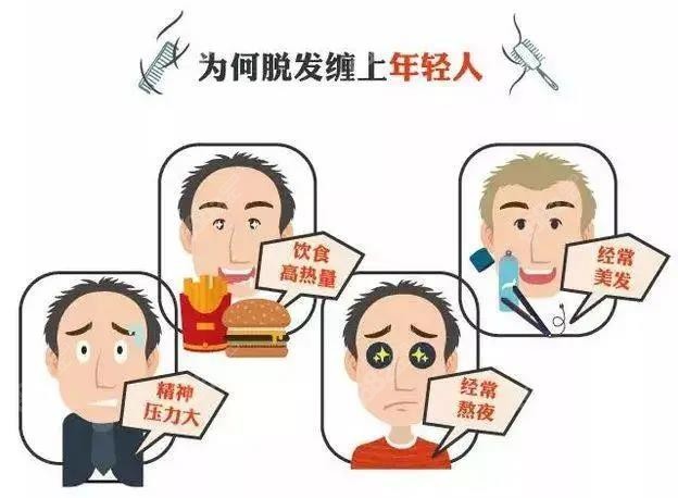 当代年轻人脱发原因