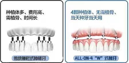 结合牙和融合牙的区别图片