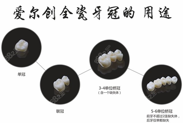 爱尔创全瓷牙的用途