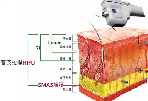 北京加减美非手术抗衰示意图