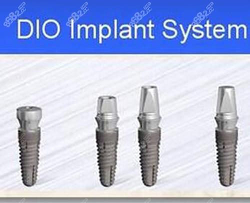 韩国DIO种植牙