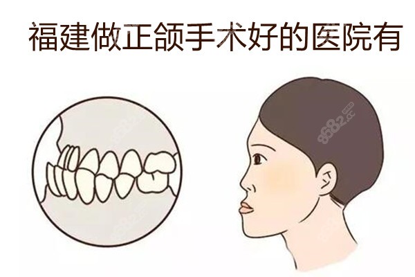 福建正颌手术