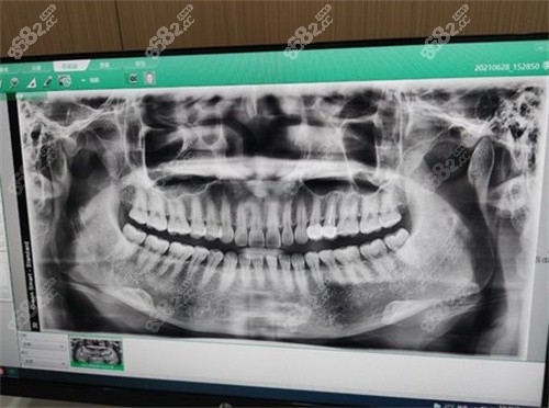武汉德韩口腔牙片