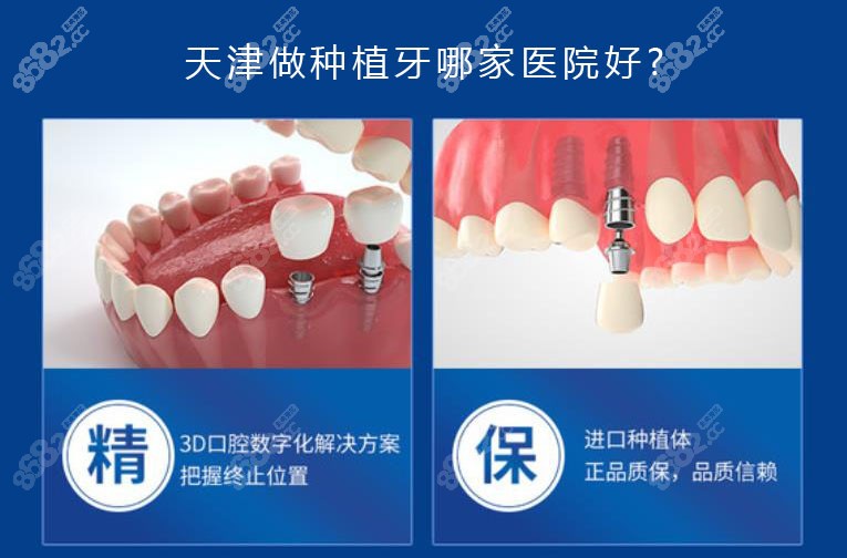 天津种植牙好的口腔医院医生排名:是有补贴政策便宜的牙科